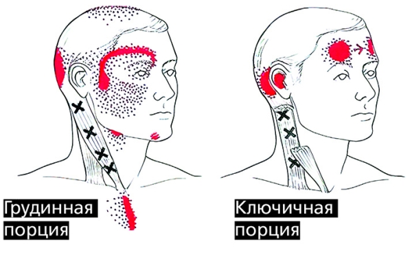 «Замороженные в мышцах чувства»: как связаны тревога, депрессия и боль?			
        
         
        «Замороженные в мышцах чувства»: как связаны тревога, депрессия и боль?
