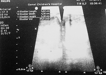 Нейрогенный мочевой пузырь			     
        Нейрогенный мочевой пузырь