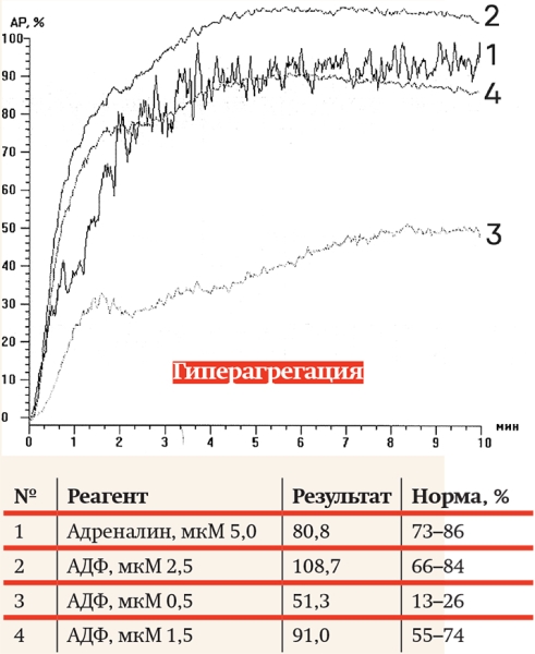Агрегатометрия: нюансы прочтения анализов			     
        Агрегатометрия: нюансы прочтения анализов