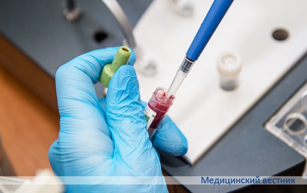 Почему не получается коагулограмма			     
        Почему не получается коагулограмма