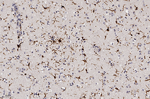 Патоморфологические изменения головного мозга при COVID-19			     
        Патоморфологические изменения головного мозга при COVID-19