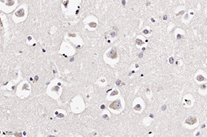 Патоморфологические изменения головного мозга при COVID-19			     
        Патоморфологические изменения головного мозга при COVID-19