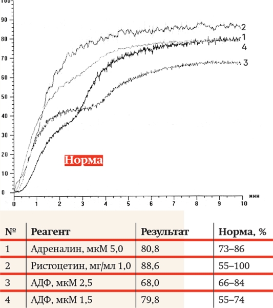 Агрегатометрия: нюансы прочтения анализов			     
        Агрегатометрия: нюансы прочтения анализов