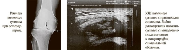 Патология суставов: кого направить на Ультразвук			     
        Патология суставов: кого направить на Ультразвук