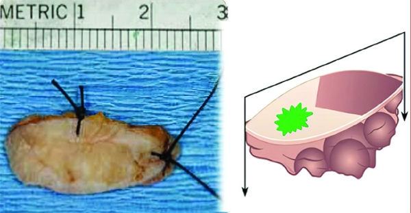 Патогистологическое сопровождение при диагностике заболеваний			     
        Патогистологическое сопровождение при диагностике заболеваний