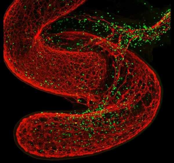 Как мозг управляет иммунными реакциями			     
        Как мозг управляет иммунными реакциями