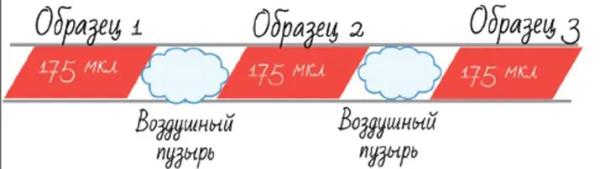 Результаты СОЭ: по Панченкову или по Вестергрену?			     
        Результаты СОЭ: по Панченкову или по Вестергрену?