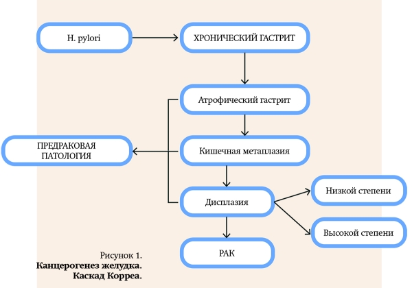 Природа хронической гастродуоденальной боли. Часть 1			     
        Природа хронической гастродуоденальной боли. Часть 1