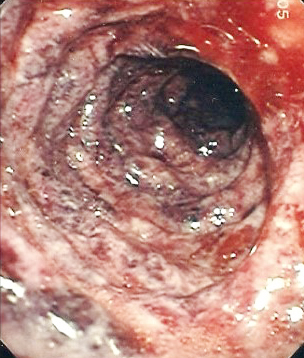 Острая гастродуоденальная боль. Часть 2			     
        Острая гастродуоденальная боль. Часть 2