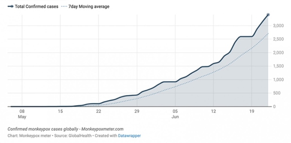Станет ли оспа обезьян новой пандемией?		 
			Станет ли оспа обезьян новой пандемией?