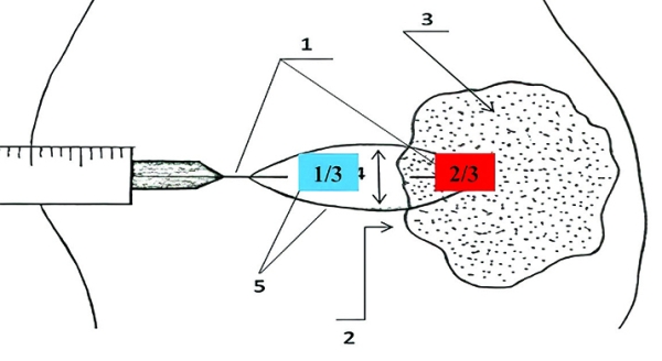 Патогистологическое сопровождение при диагностике заболеваний			     
        Патогистологическое сопровождение при диагностике заболеваний
