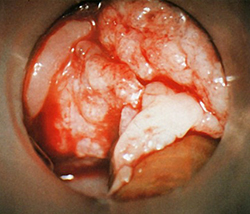 Предраковые заболевания гортани +аудио			
        
         
        Предраковые заболевания гортани +аудио