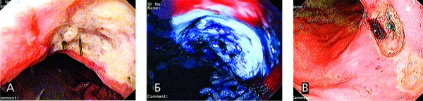 Острая гастродуоденальная боль. Часть 2			     
        Острая гастродуоденальная боль. Часть 2