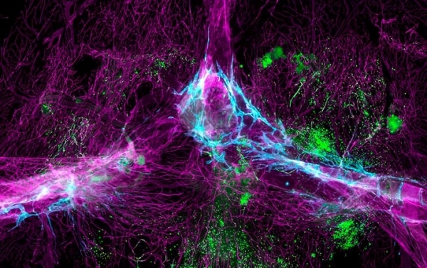 Ученые обнаружили,  что мозг не особая закрытая зона			     
        Ученые обнаружили,  что мозг не особая закрытая зона