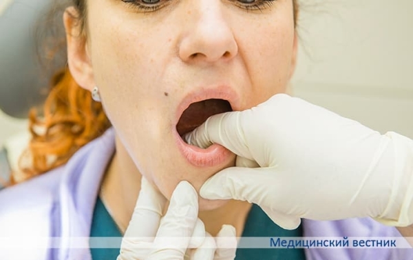 Опухоли полости рта и глотки: стратегия ранней диагностики			     
        Опухоли полости рта и глотки: стратегия ранней диагностики